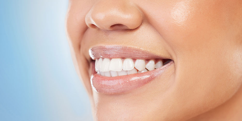 Fluoride Treatment Dorval