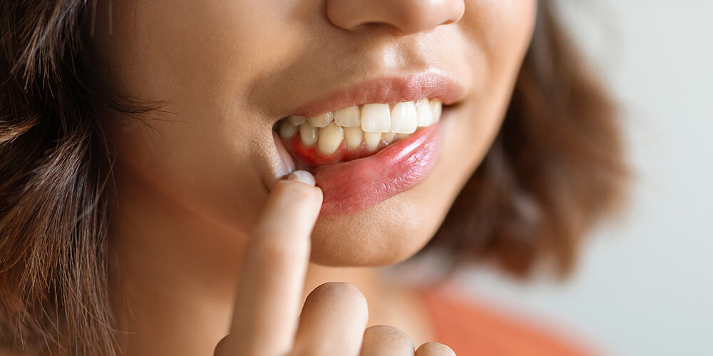 Periodontal Therapy Dorval