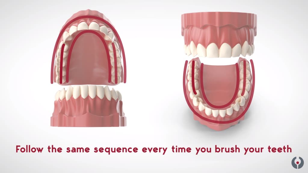 Sulcular brushing technique